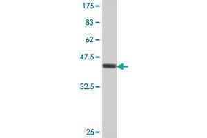 Western Blot detection against Immunogen (38. (ACAT2 antibody  (AA 104-213))