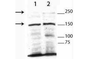 Western Blot of Rabbit Anti-TET3 Antibody. (TET3 antibody  (N-Term))