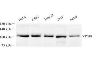Western blot analysis of VPS18 (ABIN7076177) at dilution of 1: 500 (VPS18 antibody)