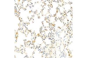 Immunohistochemistry analysis of paraffin-embedded rat lung using EIF2S2 (ABIN7073880) at dilution of 1: 2000