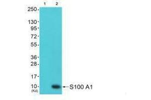 Western blot analysis of extracts from 293 cells (Lane 2), using S100 A1 antiobdy. (S1A1 antibody)