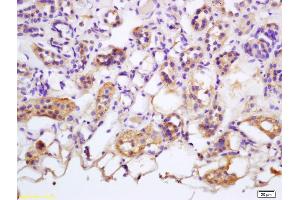 Formalin-fixed and paraffin embedded human kidney labeled with Rabbit Anti Tankyrase Polyclonal Antibody, Unconjugated (ABIN1385979) at 1:200 followed by conjugation to the secondary antibody and DAB staining (Tankyrase antibody  (AA 1140-1171))