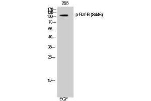 Western Blotting (WB) image for anti-B-Raf proto-oncogene, serine/threonine kinase (BRAF) (pSer446) antibody (ABIN3180451) (BRAF antibody  (pSer446))