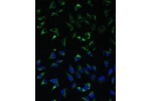 Immunofluorescence analysis of L-929 cells using USP46 Polyclonal Antibody (ABIN7271165) at dilution of 1:100 (40x lens). (USP46 antibody)
