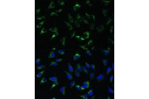 Immunofluorescence analysis of L-929 cells using USP46 Polyclonal Antibody (ABIN7271165) at dilution of 1:100 (40x lens).