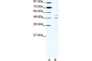 WB Suggested Anti-MITF Antibody Titration:  1. (MITF antibody  (N-Term))