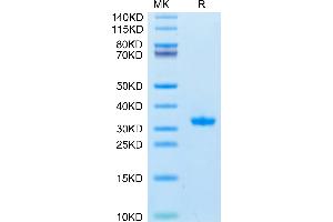 SARS-CoV-2 3CLpro (Q189K) on Tris-Bis PAGE under reduced condition. (SARS-Coronavirus Nonstructural Protein 8 (SARS-CoV NSP8) (Q189K) Protein)