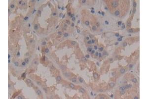 Detection of Rock2 in Human Kidney Tissue using Polyclonal Antibody to Rho Associated Coiled Coil Containing Protein Kinase 2 (Rock2) (ROCK2 antibody  (AA 904-1140))