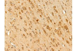 ABIN7094850 and ABIN7098901 at 1/100 staining Rat brain tissue by IHC-P.