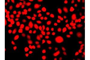 Immunofluorescence analysis of A549 cell using IFRD1 antibody. (IFRD1 antibody)