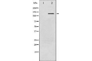 ABL1 antibody  (pTyr245)