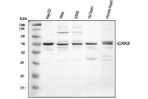 Western blot analysis of GRK5 using anti-GRK5 antibody (ABIN3042434).