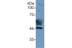 Detection of CK19 in Human Placenta lysate using Monoclonal Antibody to Cytokeratin 19 (CK19) (Cytokeratin 19 antibody  (AA 127-322))
