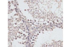 Immunohistochemistry of paraffin-embedded Rat testis using ATG14 Polyclonal Antibody at dilution of 1:100 (40x lens).