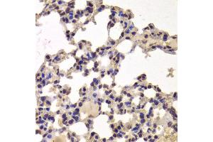 Immunohistochemistry of paraffin-embedded Mouse lung using HDAC7 antibody at dilution of 1:100 (x400 lens). (HDAC7 antibody)