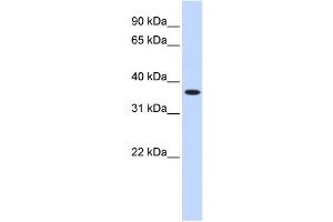 Western Blotting (WB) image for anti-Zinc Finger Protein 444 (ZNF444) antibody (ABIN2458190)