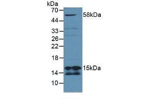 Detection of SDHD in Mouse Lung Tissue using Polyclonal Antibody to Succinate Dehydrogenase Complex Subunit D (SDHD) (SDHD antibody  (AA 1-159))