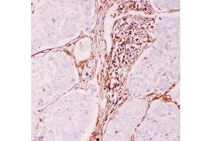 Anti-P Glycoprotein Picoband antibody, .