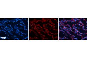 Immunohistochemistry (IHC) image for anti-Ribosomal Protein L13 (RPL13) (C-Term) antibody (ABIN2778677)