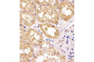 Antibody staining APIP in human kidney tissue sections by Immunohistochemistry (IHC-P - paraformaldehyde-fixed, paraffin-embedded sections). (APIP antibody  (AA 111-142))