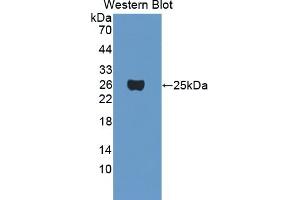 Detection of Recombinant CRYgF, Mouse using Polyclonal Antibody to Crystallin Gamma F (CRYgF)