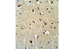 Immunohistochemistry (IHC) image for anti-rho GDP Dissociation Inhibitor (GDI) alpha (ARHGDIA) antibody (ABIN3001701) (ARHGDIA antibody)