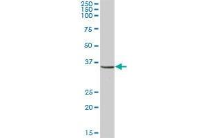 UMPS MaxPab polyclonal antibody. (UMPS antibody  (AA 1-480))