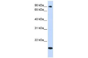 TSR1 antibody used at 1 ug/ml to detect target protein. (TSR1 antibody)
