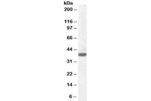 Western blot testing of human cerebellum lysate with Laforin antibody at 0. (EPM2A antibody)