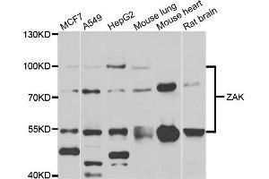 Western blot analysis of extracts of various cell lines, using ZAK antibody. (ZAK antibody)