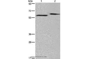 Western blot analysis of Human fetal brain and mouse brain tissue, using EGR4 Polyclonal Antibody at dilution of 1:400 (EGR4 antibody)