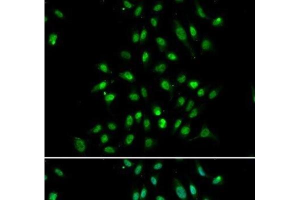 CXXC1 antibody