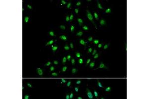 Immunofluorescence analysis of A549 cells using CXXC1 Polyclonal Antibody (CXXC1 antibody)