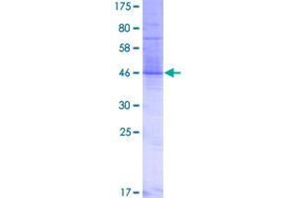 TMEM17 Protein (AA 1-198) (GST tag)