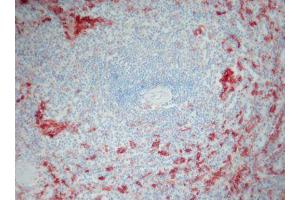 Image no. 1 for anti-Ionized Calcium-binding Adapter Molecule 1 (IBA1) antibody (ABIN379966) (Iba1 antibody)