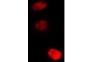 Immunofluorescent analysis of STAMBP staining in U2OS cells.