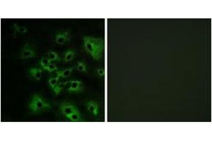 Immunofluorescence analysis of HeLa cells treated with EGF 200nM 5', using HER4 (Phospho-Tyr1284) Antibody. (ERBB4 antibody  (pTyr1284))
