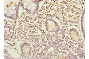 Immunohistochemistry of paraffin-embedded human small intestine tissue using ABIN7156305 at dilution of 1:100 (IP6K2 antibody  (AA 1-180))