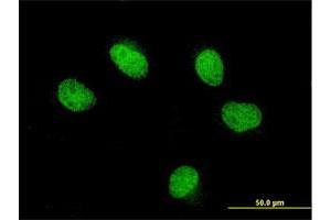 Immunofluorescence of monoclonal antibody to FOXQ1 on HeLa cell. (FOXQ1 antibody  (AA 110-219))
