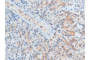 Immunohistochemistry (IHC) image for anti-Checkpoint Kinase 2 (CHEK2) (pThr387) antibody (ABIN6256554)