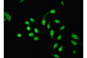 Immunofluorescent analysis of Hela cells using ABIN7163042 at dilution of 1:100 and Alexa Fluor 488-congugated AffiniPure Goat Anti-Rabbit IgG(H+L) (PHF1 antibody  (AA 151-360))