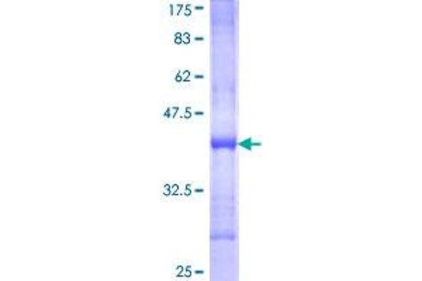 NRK Protein (AA 1483-1582) (GST tag)