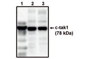 Image no. 1 for anti-MAP/microtubule Affinity-Regulating Kinase 3 (MARK3) antibody (ABIN793597) (MARK3 antibody)