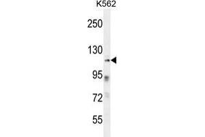 ZNF99 Antibody (N-term) western blot analysis in K562 cell line lysates (35 µg/lane).