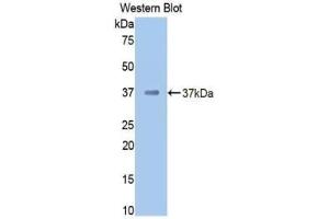 Western blot analysis of the recombinant protein. (Prothrombin antibody  (AA 325-618))