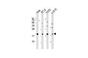 All lanes : Anti-ANC11 Antibody (C-Term) at 1:2000 dilution Lane 1: Hela whole cell lysate Lane 2: PC-3 whole cell lysate Lane 3: T47D whole cell lysate Lane 4: U-2OS whole cell lysate Lysates/proteins at 20 μg per lane. (ANAPC11 antibody  (AA 56-94))