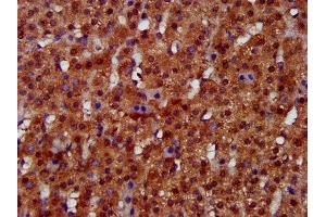 IHC image of ABIN7157790 diluted at 1:300 and staining in paraffin-embedded human adrenal gland tissue performed on a Leica BondTM system. (FUK antibody  (AA 579-758))