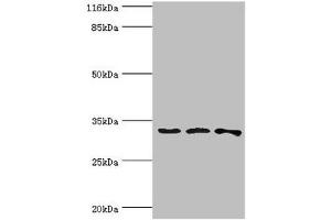 Western blot All lanes: STARD10 antibody at 2 μg/mL Lane 1: 293T whole cell lysate Lane 2: k562 whole cell lysate Lane 3: Mouse heart tissue Secondary Goat polyclonal to rabbit IgG at 1/10000 dilution Predicted band size: 33 kDa Observed band size: 33 kDa (STAR antibody  (AA 1-291))