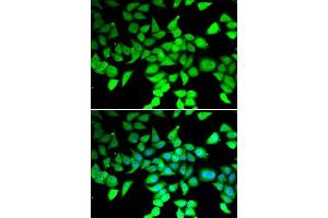 Immunofluorescence analysis of MCF-7 cells using HDAC7 antibody. (HDAC7 antibody  (AA 400-500))