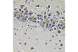 Immunohistochemistry of paraffin-embedded mouse brain using PLCG1 Antibody. (Phospholipase C gamma 1 antibody)
